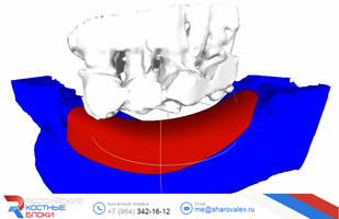 RBB 01. Модель челюсти, модель блока, встречные зубы