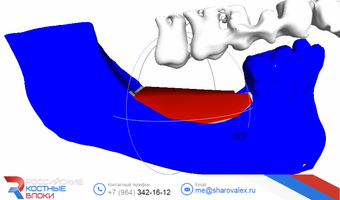 RBB 02. Модель челюсти, модель блока, встречные зубы