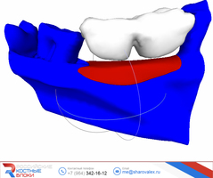 RBB 03. Модель челюсти, модель блока, встречные зубы