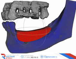 RBB 05. Модель челюсти, модель блока, встречные зубы