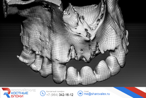 RBB 07. Модель челюсти, модель блока, встречные зубы