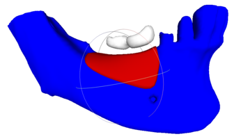 RBB 06. Модель челюсти, модель блока, встречные зубы