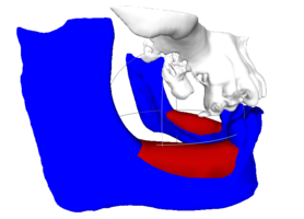 RBB 11. Модель челюсти, модель блока, встречные зубы