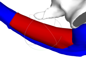 RBB 11. Модель челюсти, модель блока, встречные зубы