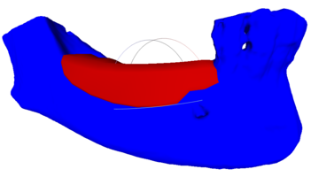RBB 16. Модель челюсти, модель блока, встречные зубы