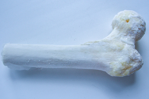 Фрагмент эпифиз бедренной кости